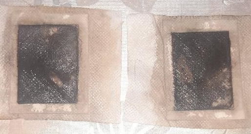 Apr&egrave;s utilisation du patch